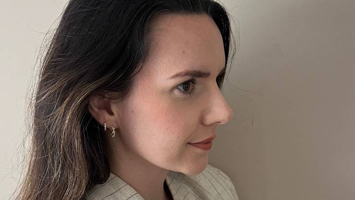 I got a 15-minute non-surgical nose job and this is my only regret