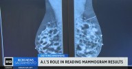 UC Davis to co-lead $16 million study axamining AI's role in reading mammograms