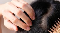 Meet Creator Behind Taiwan's Miraculous Hair Serum That Promises to Restore Hair Growth In 20 Days