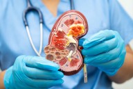 Kidney stone prevention made simple: the mineral your body actually needs