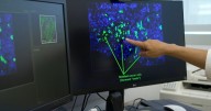 Researchers seek to halt recurrence of breast cancer by targeting dormant "sleeper cells"