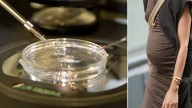 Scientists create human eggs from skin cells in fertility breakthrough