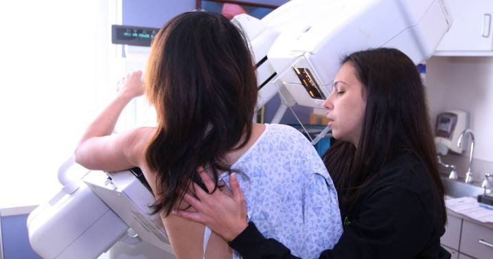 Study: Missing first mammogram tied to increased risk of breast cancer death