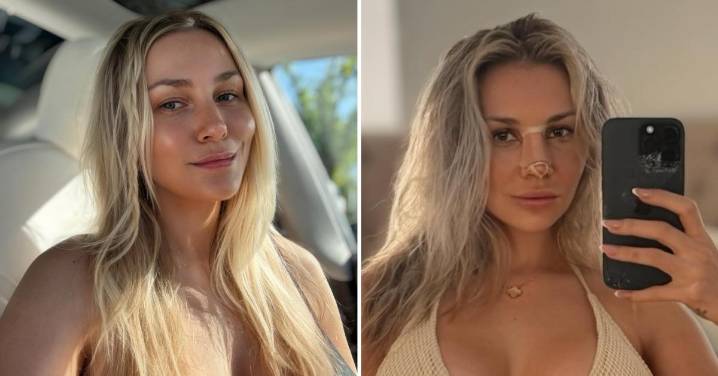 Courtney Stodden Reveals Nose Job Results in Stunning Photo and Raves Over 'Self