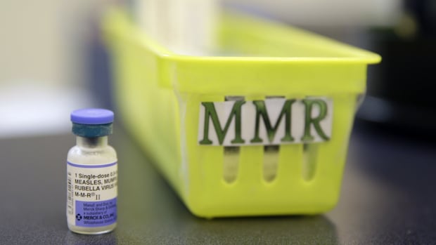 Alberta's measles outbreaks surpass case counts reported for entire U.S.