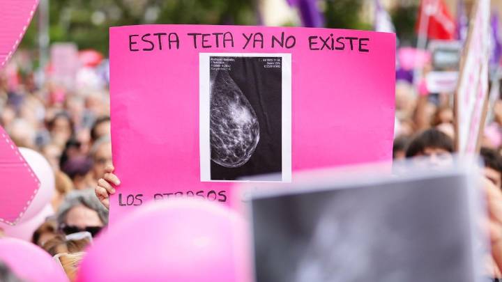 La guerra de cifras en la crisis del cribado de cáncer de mama en Andalucía: "Creemos que pueden ser 20.000, no 2.000, ni 2.317"