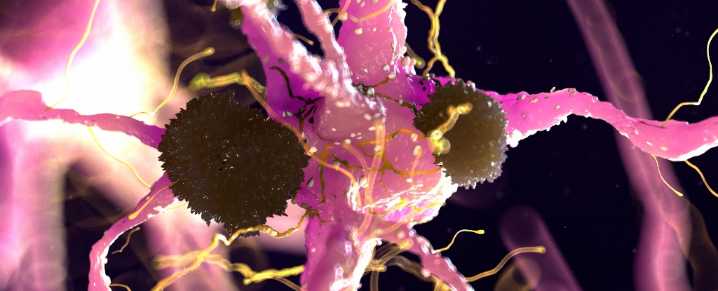 A Signal Hidden in The Brain May Reveal Alzheimer's Years in Advance