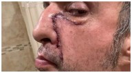 Exintegrante de Molotov, Tito Fuentes, enfrenta recuperación tras 11 cirugías y coma inducido por adicciones