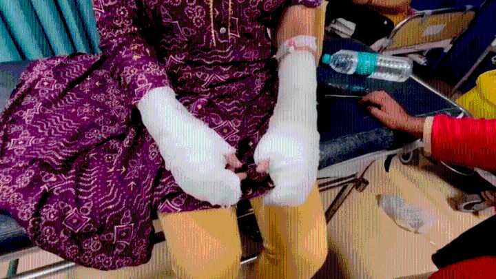 DU student acid attack case: ‘No trace of acid’ & rape FIR against girl’s father by ‘stalker’s’ wife