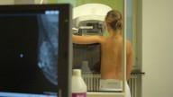 'Amama' denunciará al Servicio Andaluz de Salud (SAS) por los fallos en los cribados de cáncer de mama