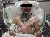Family of man injured in Mark Sanchez stabbing gives update, felony charged filed against ex