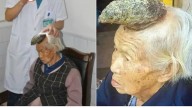 El extraño caso de la “abuela unicornio”: a una mujer en China le creció un cuerno de trece centímetros en la frente