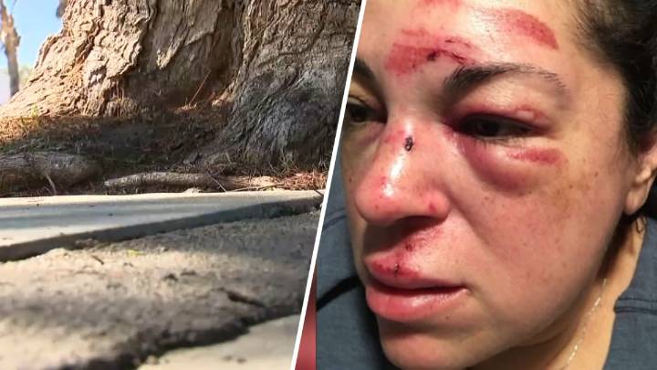 Whittier woman reaches $7.5M settlement after sidewalk fall