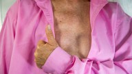 Cáncer de mama: la importancia de la prevención, la detección precoz y el apoyo psicológico