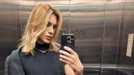 Influencer Dies at Age 31 After Complications From Cosmetic Surgery: Report
