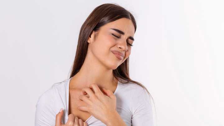 Psoriasis, una enfermedad que en el 40 % de los casos alcanza la categorización de moderada y severa