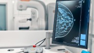 La ministra de Sanidad pide a las comunidades autónomas los datos de cribado de cáncer de mama: "Han desprotegido a las mujeres"
