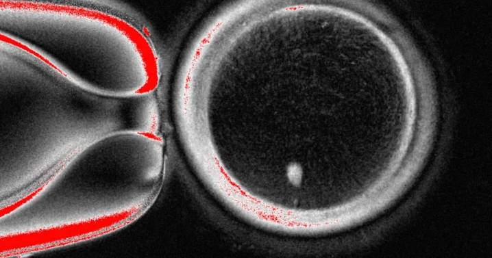 Investigadores convierten células de piel humana en óvulos, pero aún no son viables
