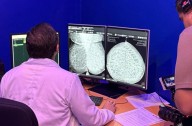 Quintana Roo y Roche marcan un precedente mundial al implementar IA en 9 mil estudios para la detección temprana del cáncer de mama