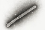 First flu death of 2025-26 season announced in North Carolina: NCDHHS
