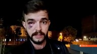 Un periodista, agredido por radicales 'abertzales' que se dirigían al evento cancelado de Vito Quiles en Navarra