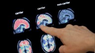Texans to vote on proposition funding dementia research
