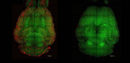 VIDEO: Consiguen revertir el Alzheimer usando nanopartículas