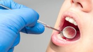 SEP: 80% de escuelas prohíben comida chatarra; pero 76% de niños padecen caries