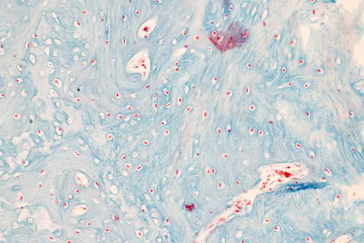 Novel CLIC5 Gene Therapy Uses AAV Technology to Treat Hearing Loss