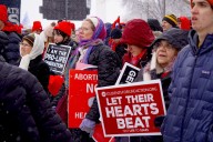 Hyde Amendment impact affected by state Medicaid programs