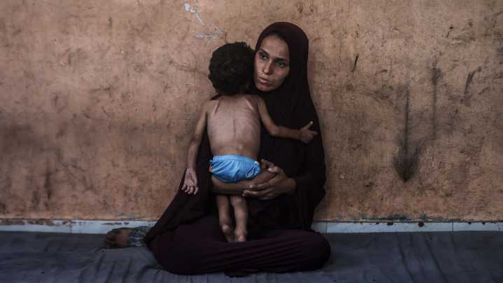 Los bloqueos de Israel disparan la desnutrición en Gaza: más de 54.600 menores de cinco años padecen desnutrición aguda