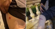 Fotoperiodista de El Comercio es herido por perdigones mientras cubría movilización en el Cercado de Lima Últimas