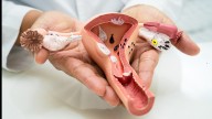 These ‘Silent’ Cancers Are Attacking Women, And Most Don’t See It Coming