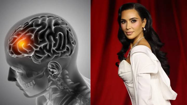 ¿Qué es aneurisma cerebral? La enfermedad que le diagnosticaron a Kim Kardashian
