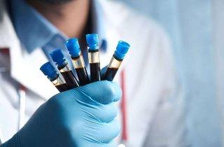 Nuevos tratamientos mejoran la salud y calidad de vida de pacientes con hemofilia