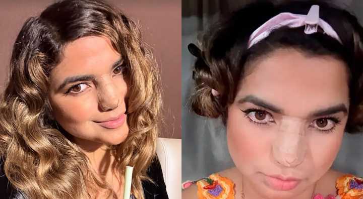 Susana Alvarado, cantante de Corazón Serrano, DEJA EN SHOCK al mostrar los resultados de su CIRUGÍA a la nariz