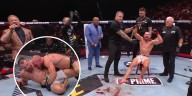 Dramático triunfo de una figura de la UFC: sufrió una escalofriante lesión en pleno combate y festejó con el tobillo quebrado