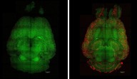 Scientists reverse Alzheimer’s in mice using nanoparticles