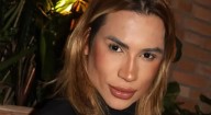 El influencer Júnior Dutra muere a los 31 años tras someterse a esta cirugía estética del momento