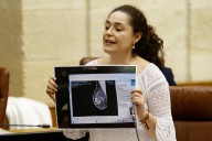 La teta de Anabel llega al Parlamento: Por Andalucía muestra una mamografía supuestamente manipulada