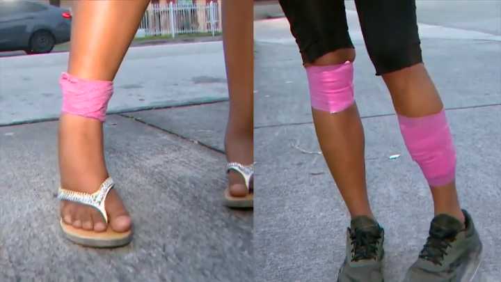 Mother speaks out after she and her daughter were attacked by dogs in NW Miami