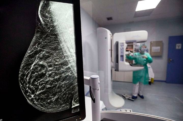 El cribado de cáncer de mama llega al 85% de mujeres citadas
