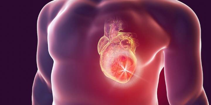 Identifican una proteína que agrava el riesgo de muerte súbita después de un infarto