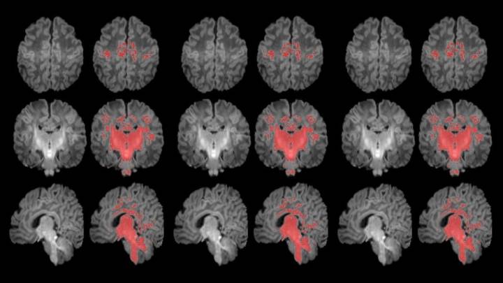 La contaminación durante el embarazo ralentiza la maduración del cerebro en recién nacidos