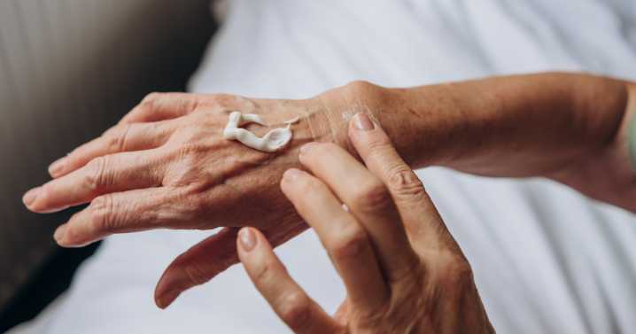 How to Treat Eczema on Every Part of Your Body