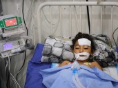 Bomb in Gaza’s rubble wounds twins who thought it was a toy