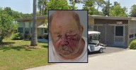 Florida man shot woman after insulting her on way to play cards, gets beat up by husband: Cops