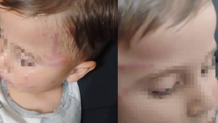 Niño de 2 años fue atacado por un perro mientras jugaba en Torreón; su hermana lo intentó defender