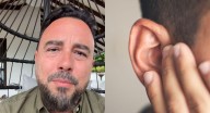 Tulio Recomienda confiesa que perdió el oído por un barotrauma: ¿en qué consiste esta afección y por qué se produce?
