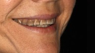 ¿De qué color tienes tus dientes? Esto es lo que revela cada tono sobre tu salud bucal